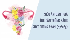 Siêu âm đánh giá ống dẫn trứng bằng chất tương phản (HyFoSy)